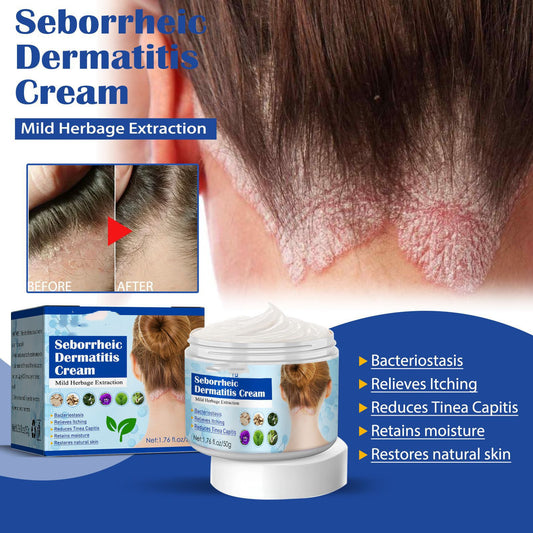 Herbal Botanical Seborrheic Dermatitis Cream – Advanced Cosmetic Care for Head Acne, Hair Loss Tendencies & Scalp Itch Profiles (50g)