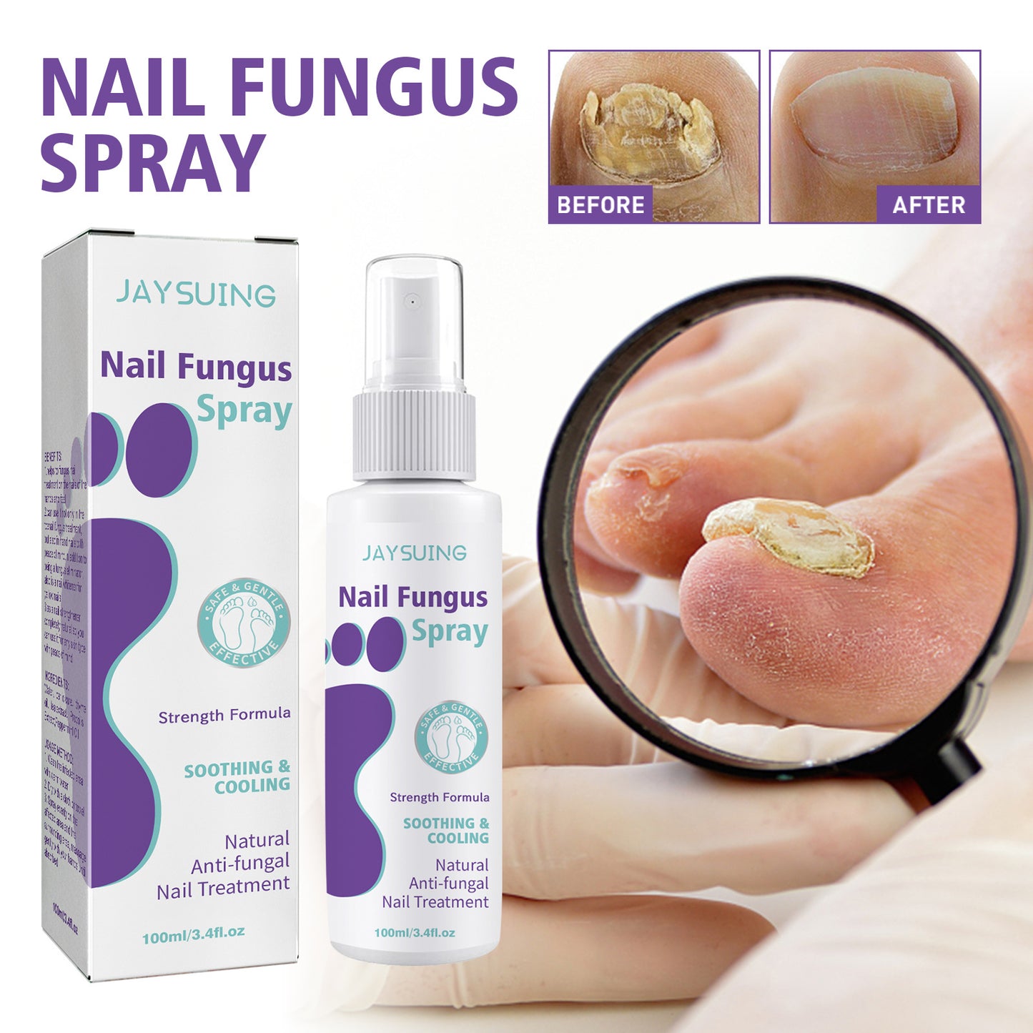 JAYSUING Nail Fungus Spray - See Visible Results in 7 Days!