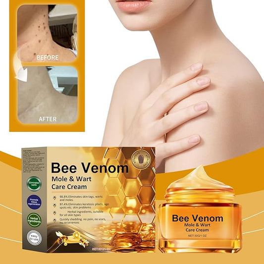 WEST MONTH Wart Removal Cream Professional Herbal Formula No Trace - Get Rid of Warts and Moles Without a Trace with Natural Formula