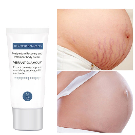 VIBRANT GLAMOUR Postpartum Dermal Smoothing Cream – Advanced Cosmetic Care for Pregnancy Stretch Marks & Elasticity Loss