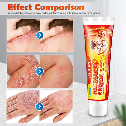 SUMIFUN Herbal Botanical Balancing Ointment – Advanced Cosmetic Care for Ringworm, Eczema-Prone & Flaky Psoriasis-Tendency Skin Profiles