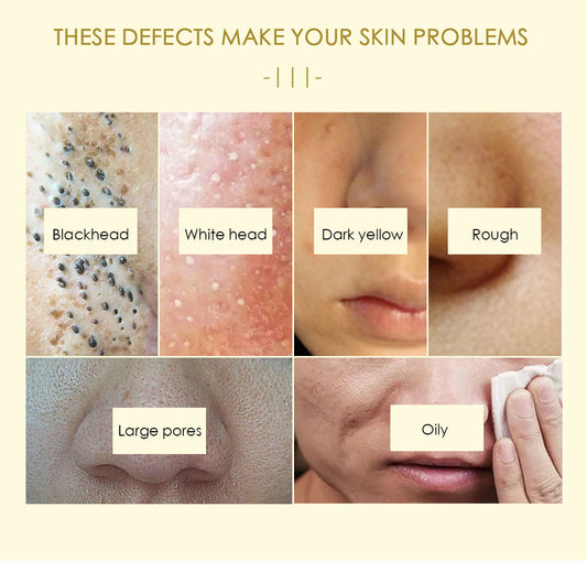 YOXIER Collagen 24K Gold Facial Mask Moisturizing, Blackhead and Acne Remover, Anti-Oxidation, Anti-Aging Skin Care Mask