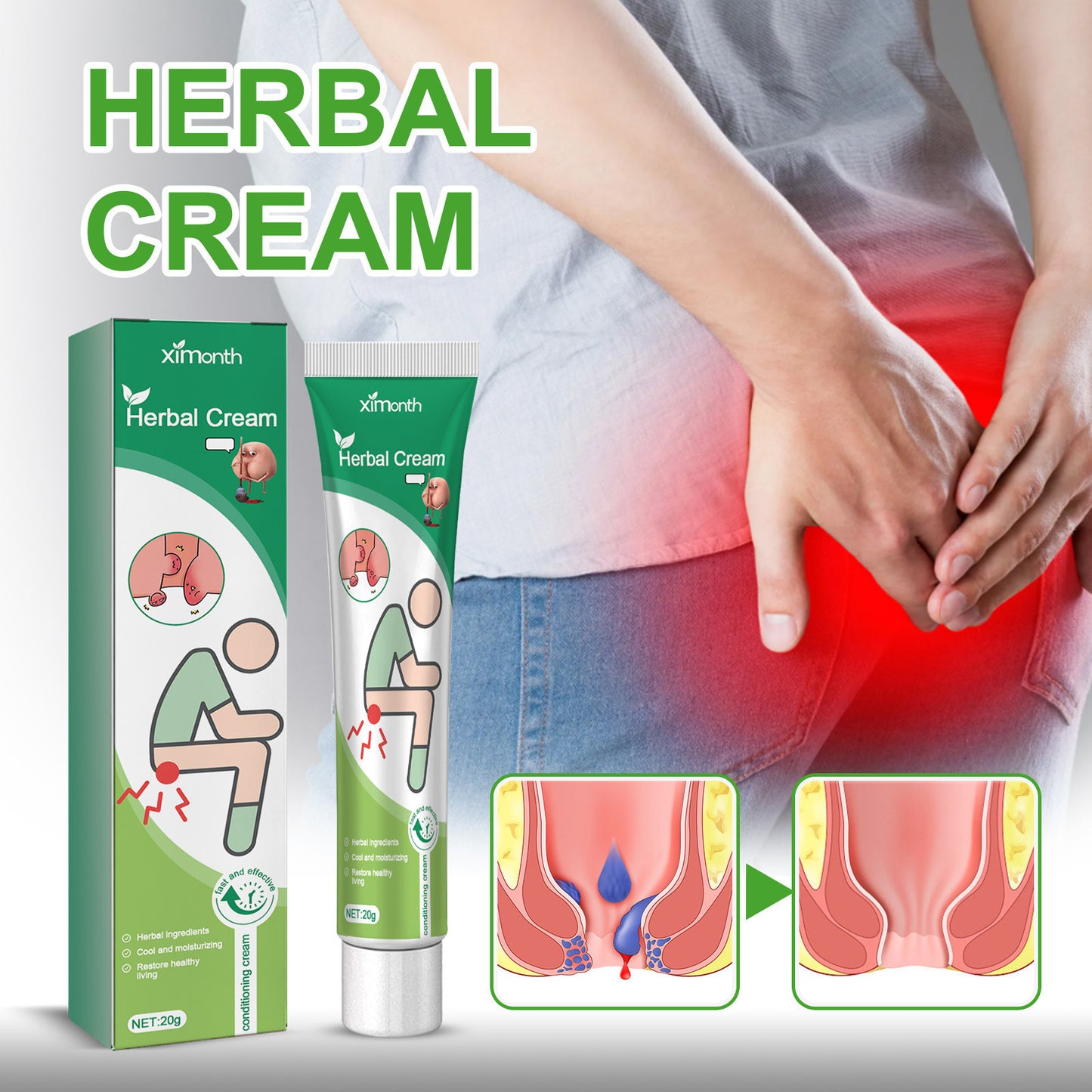 XIMONTH Herbal Hemorrhoid Relief Cream – Fast-Acting Perianal Itch, Pain & Irritation Support