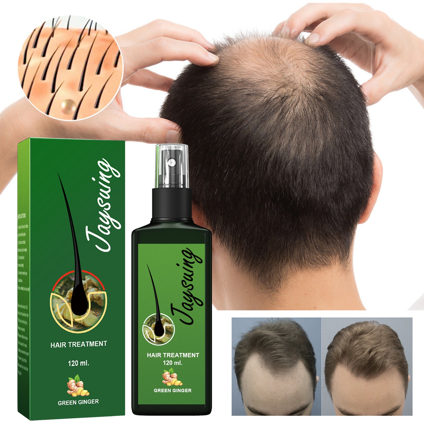 Jaysuing Hair Loss Support, Strengthens Hair, Nourishes Root Growth And Thickens Scalp Massage Nutrient Solution