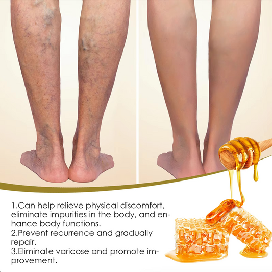 SOUTH MOON Lymphatic Detox, Fat Burner, Slimming, Insomnia Relief, Leg Swelling and Varicose Veins Support Gel