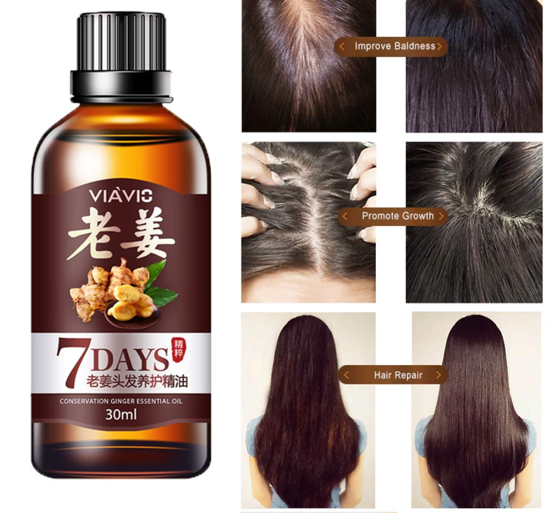 DAGEDA New Ginger Hair Growth Oil Essence, Stops Hair Loss, Dense Thicken Hair, Balding Supports Healthy Hair Growth for Women & Men-30ml - Buy 3 Pay For 2