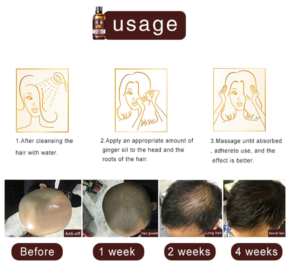 DAGEDA New Ginger Hair Growth Oil Essence, Stops Hair Loss, Dense Thicken Hair, Balding Supports Healthy Hair Growth for Women & Men-30ml - Buy 3 Pay For 2