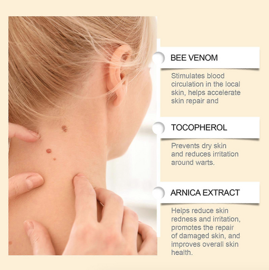 HOLIKEA Advanced Bee Venom Skin Repair Serum – Anti-Wart, Anti-Mole & Rejuvenating Formula