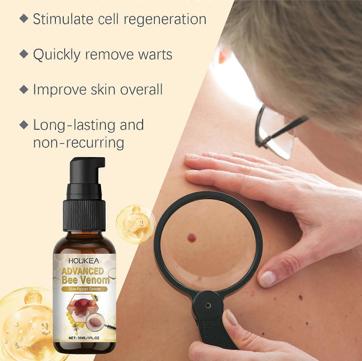HOLIKEA Advanced Bee Venom Skin Repair Serum – Anti-Wart, Anti-Mole & Rejuvenating Formula
