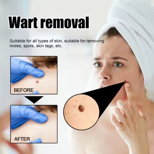 XIMONTH Perfect Shine Whitening Blemish and Wart Support Cream