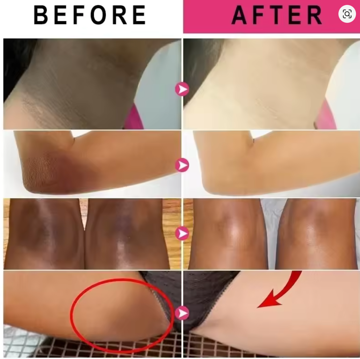 JAYSUING Face, Body and Intimate Area Whitening Snow Bleach Cream Fast Bleaching Brighten Inner Thigh Cream Bleach for Intimate Area