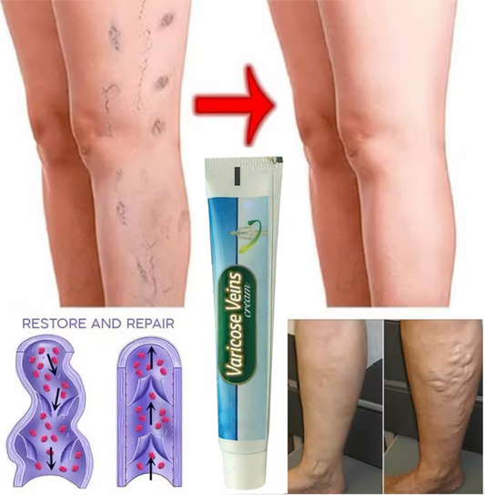 JAYSUNG Varicose Vein Cream – Advanced Relief for Leg Pain, Swelling & Spider Veins