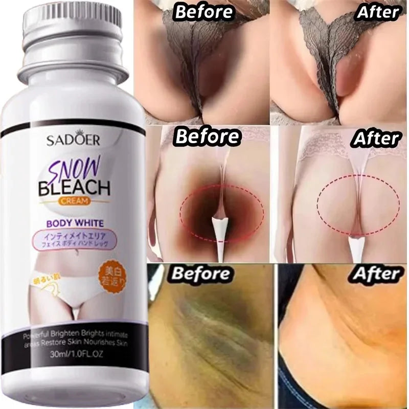 HOGI Whitening Cream Private Parts (Vagina) Underarm Bleaching Serum Whiten Butt Knee Brighten Inner Thigh Intimate Parts Dark Remove Melanin