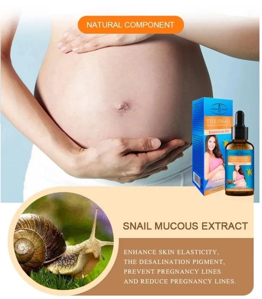 AICHUN BEAUTY Snail Belly Massage Oil (30ml) – Postpartum Skin Toning & Stretch Mark Appearance
