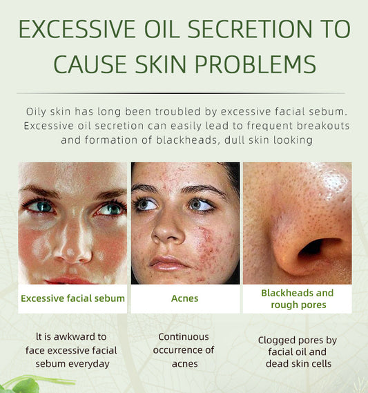 JoyPretty Herbal Acne Cream For Reducing Acne Marks