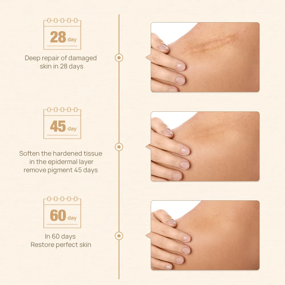 LANBENA Herbal Scar Remove Cream - skin issues such as scars, burn marks, surgical scars, acne scars, and stretch marks Remover