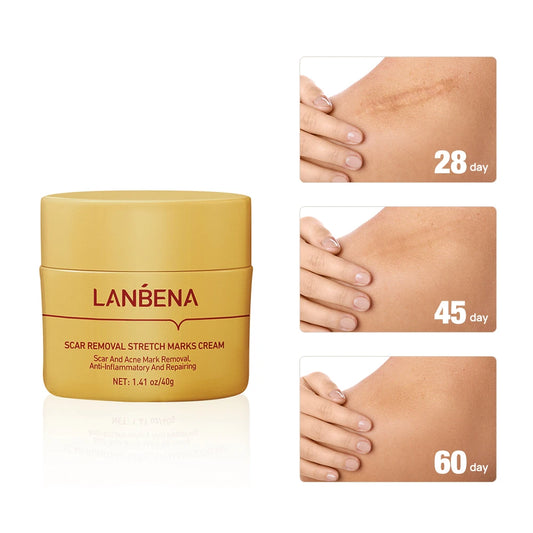 LANBENA Herbal Scar Remove Cream - skin issues such as scars, burn marks, surgical scars, acne scars, and stretch marks Remover