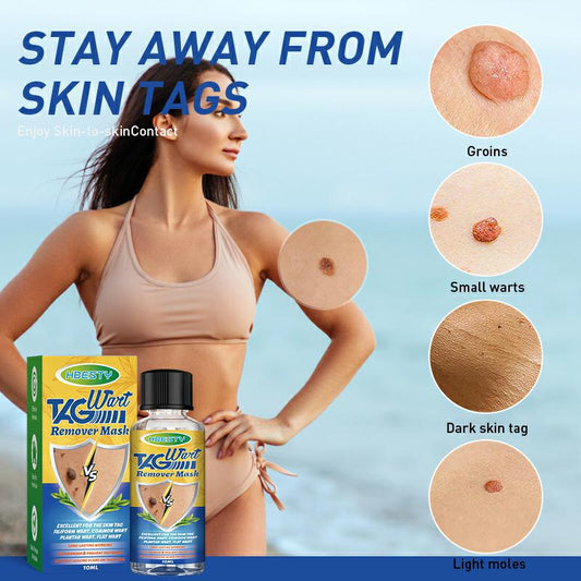 HBESTY Tag Wart Remover - Herbal Facial Mole Removal Solution