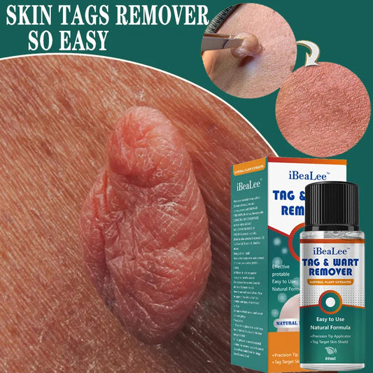 iBeaLee Precision Tag & Wart Remover Support – Natural Plant Extract Solution for All Skin (Genital & Body)