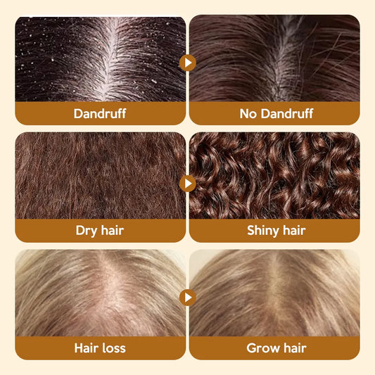 African Hair Growth Products - 100% Pure Batana Hair Growth Oil for Hair Loss Prevention, Strengthens and Extends Hair, Prevents Breakage