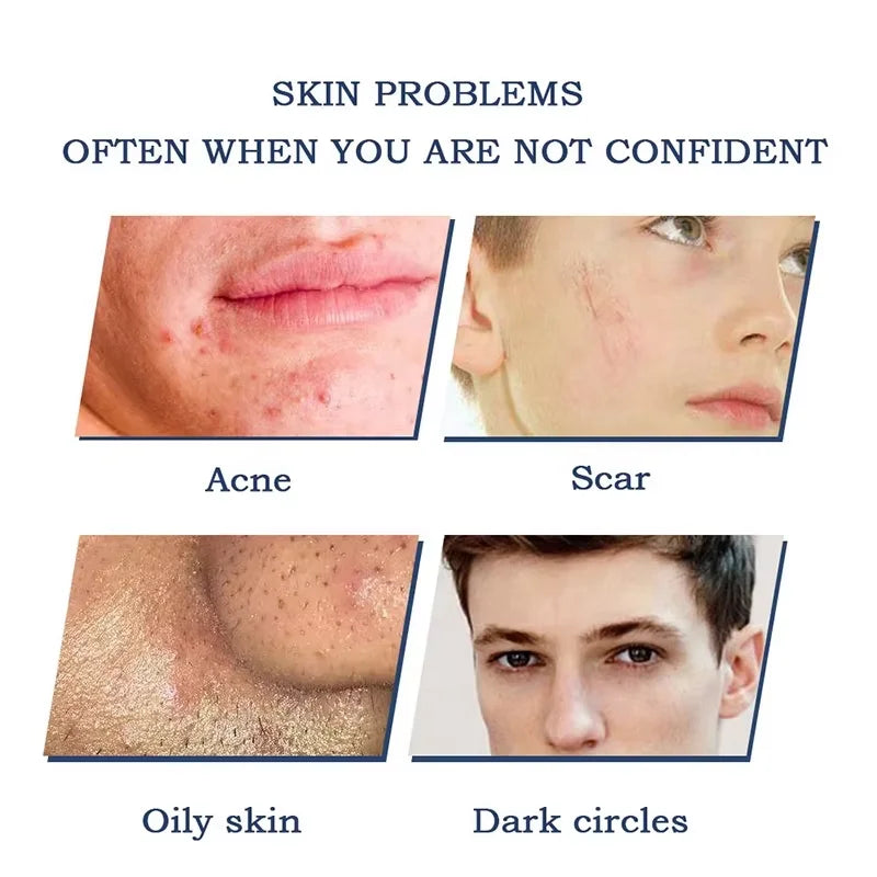 Men's Revitalizing BB Cream & Concealer – Water-Based, Lightweight Foundation for Tone Correction (30g)