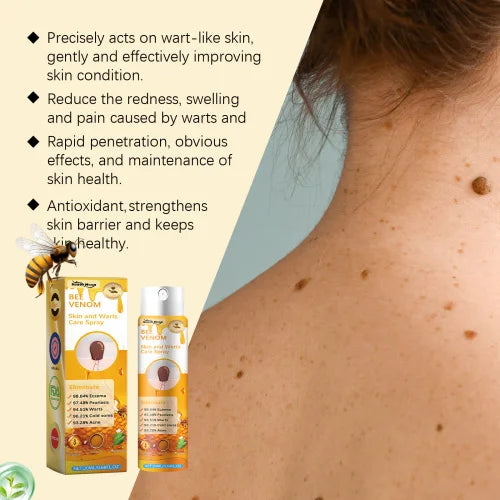SOUTH MOON Multi-Benefit Skin Care Spray – Wart, Eczema & Psoriasis Relief with Bee Venom & Tea Tree Oil