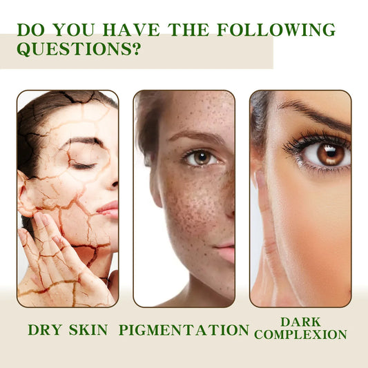 Ouhoe Vitamin C Dark Spot Serum – Niacinamide, Hyaluronic Acid for Brightening, Anti-Aging & Pore Minimizing (30ml)