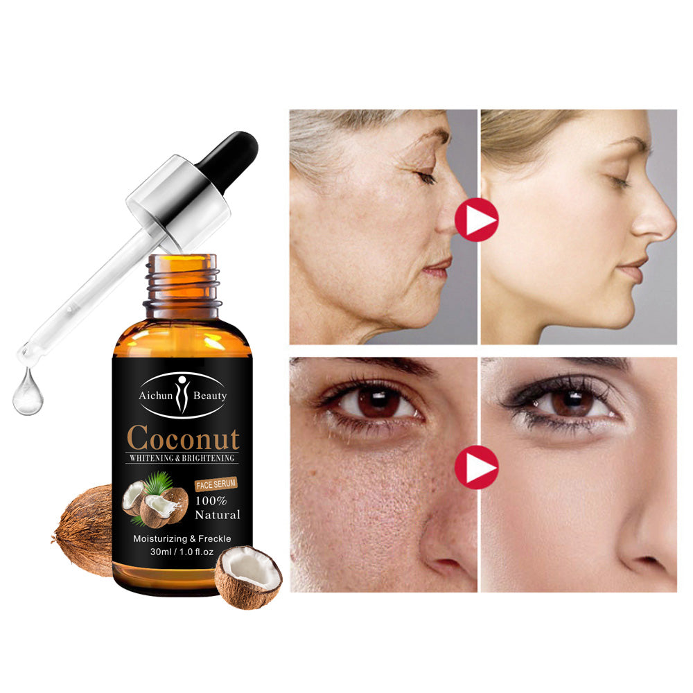 AICHUN BEAUTY Coconut Face Whitening Serum – Brightening, Moisturizing & Dark Spot Reduction (30ml)