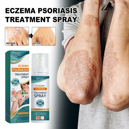 XIMONTH Herbal Eczema & Psoriasis Relief Spray – Fast-Acting Itch, Redness & Skin Repair (100ml)
