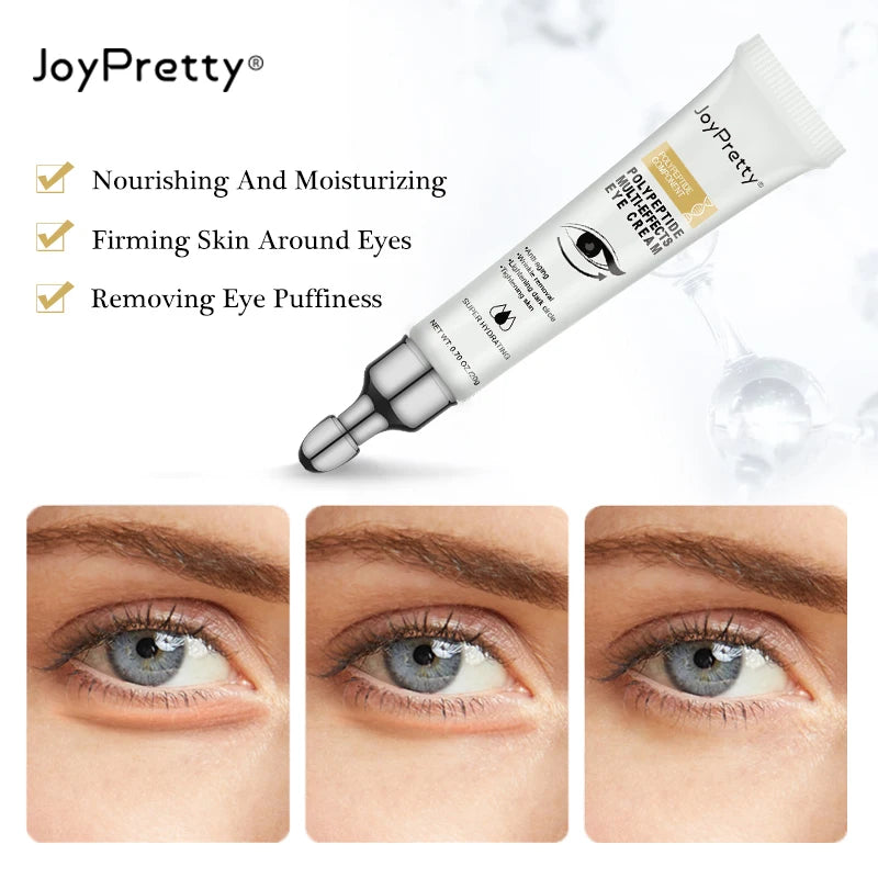 JOYPREETY Eye Cream: Dark Circle, Under-Eye Bag & Wrinkle Remover for Brighter Eyes (20g)