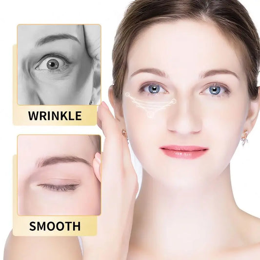 ROREC Snail Extract Anti-Winkle Eye Cream