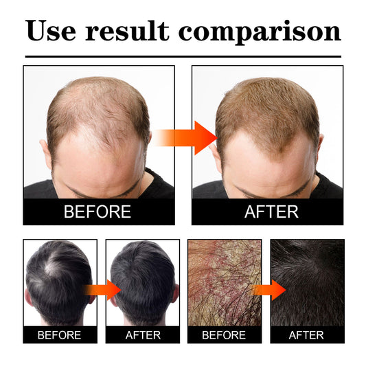 WEST & MONTH Anti-Hair Loss and Hair Strengthening Spray - 100ml