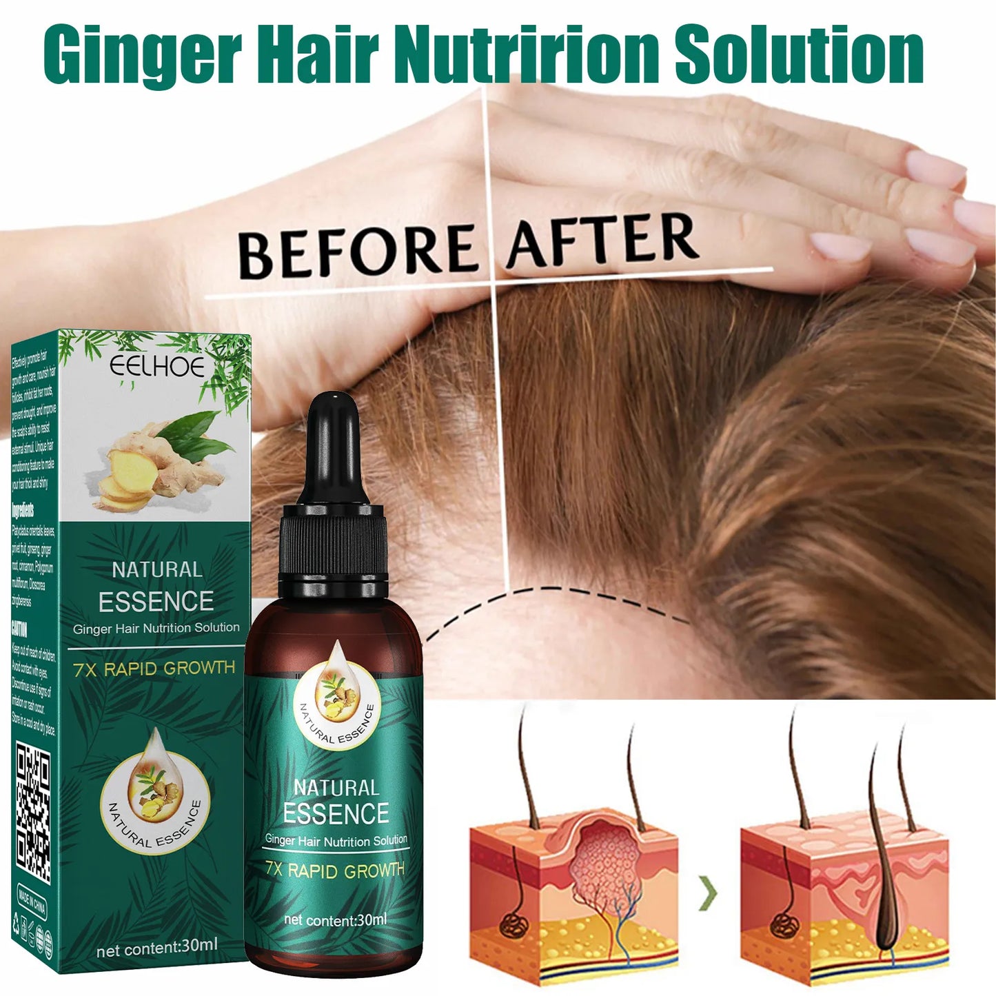 EELHOE Natural Essence Ginger Hair Care for Hair Loss - Restores Hair Follicles, Thicker Hair, 30ml - Buy 3, Pay for 2