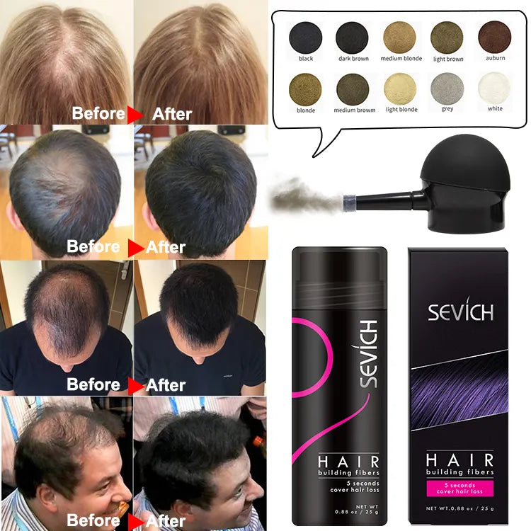 SEVICH Powder Extension Thinning Thickening Hair Growth - Instant Hair Density, Volume Boost Powder