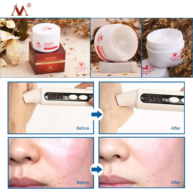 MeiYanQiong Anti-Wrinkle Face Cream with Hyaluronic Acid 40g - Wrinkle Reduction, Brightening Effect, Deep Hydration