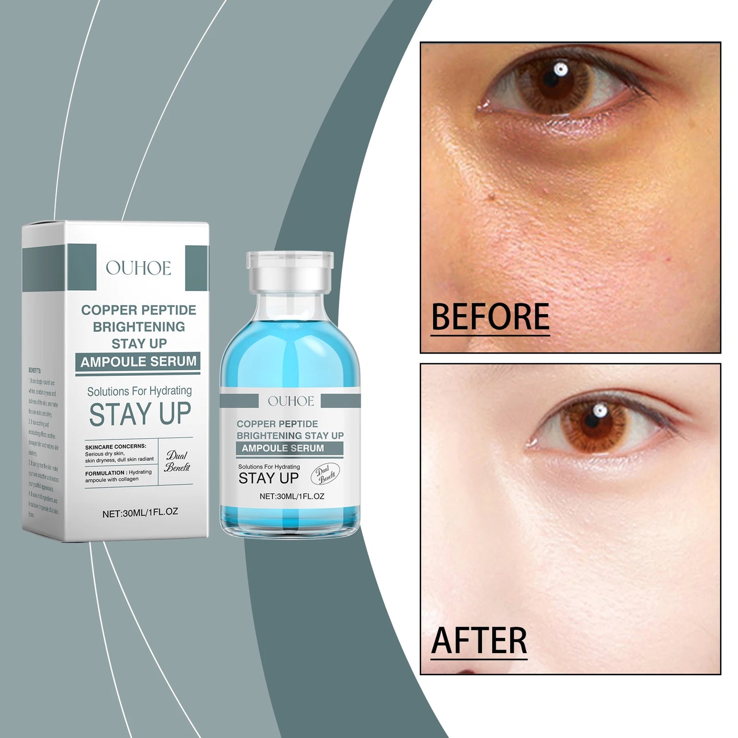 OUHOE Copper Peptide Brightening Stay Up Ampoule Serum - Brightening Effect, Supports Collagen Production