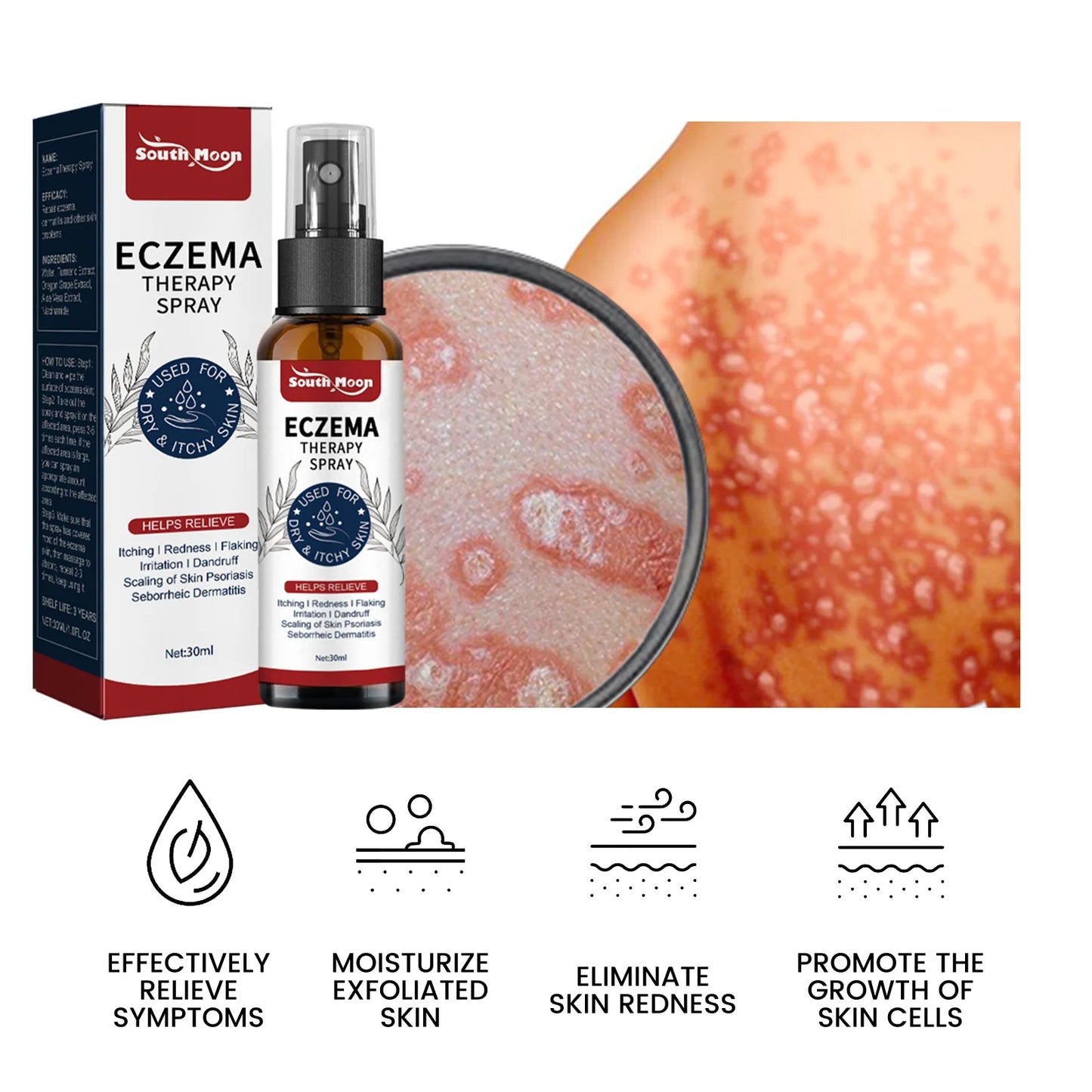 South Moon Calfskin Soothing Psoriasis Relief Spray – Effective Itch, Redness & Skin Repair (30ml)