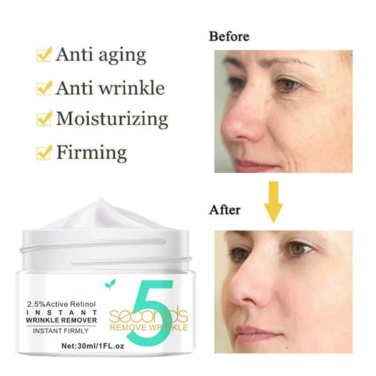 VOVO Active Retinol Anti-Aging and Anti-Wrinkle Moisturizing Face Cream 30g/ml - Buy More Pay Less