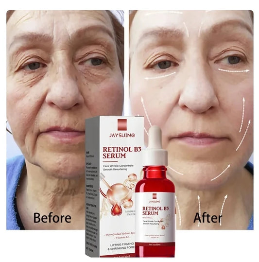 JAYSUNG Retinol Facial Essence – Hydrating & Wrinkle Fading Serum with Hyaluronic Acid (30ml) - Korean Skin Care Products