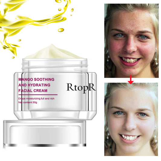 RTOPR Moisturizing Sodium Hyaluronate Repair Cream 30ml - Hydrate and nourish your skin