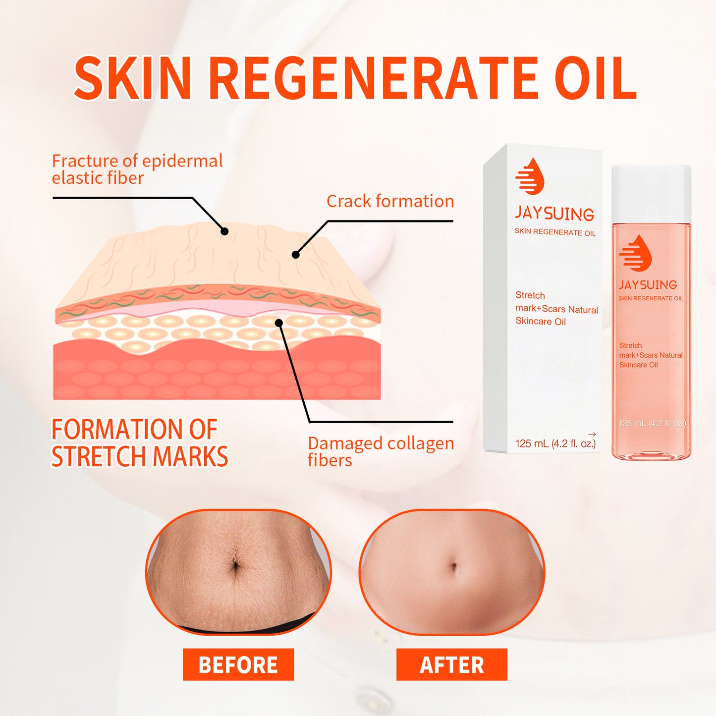 Advanced Scar & Stretch Mark Remover – Postpartum Fat Burner & Waist Slimming Body Oil for Cellulite Reduction & Skin Firming