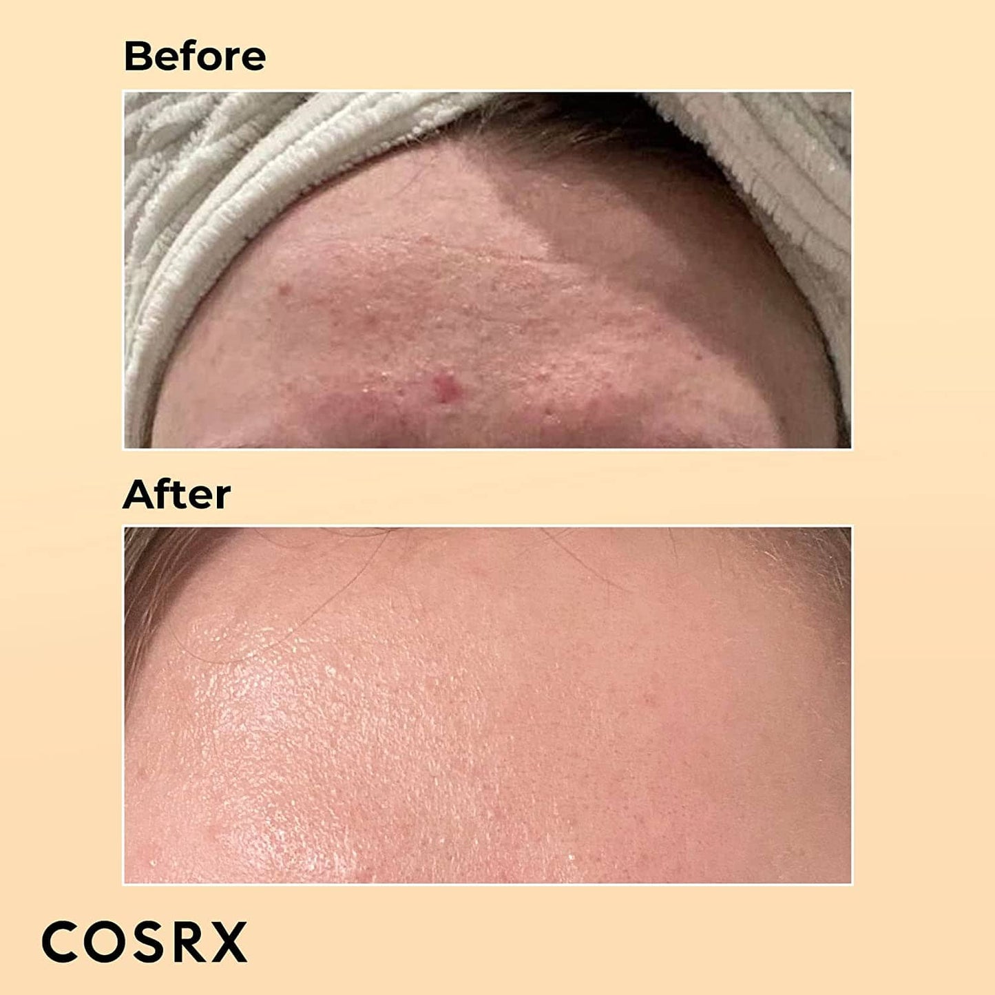 COSRX Snail Mucin 96 Essence – Korean Skincare Serum for Anti-Aging, Repair & Hydration (100ml)- Buy 3, Pay For 2