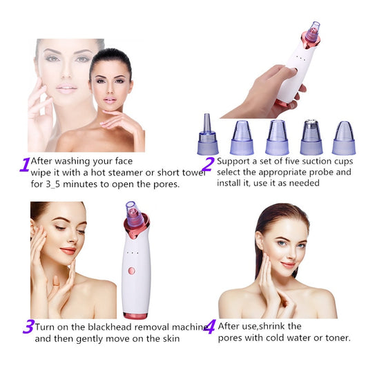 Advanced 3-Speed Intelligent Pore Vacuum – USB Rechargeable Deep Impurity Suction & Skin Refining Instrument