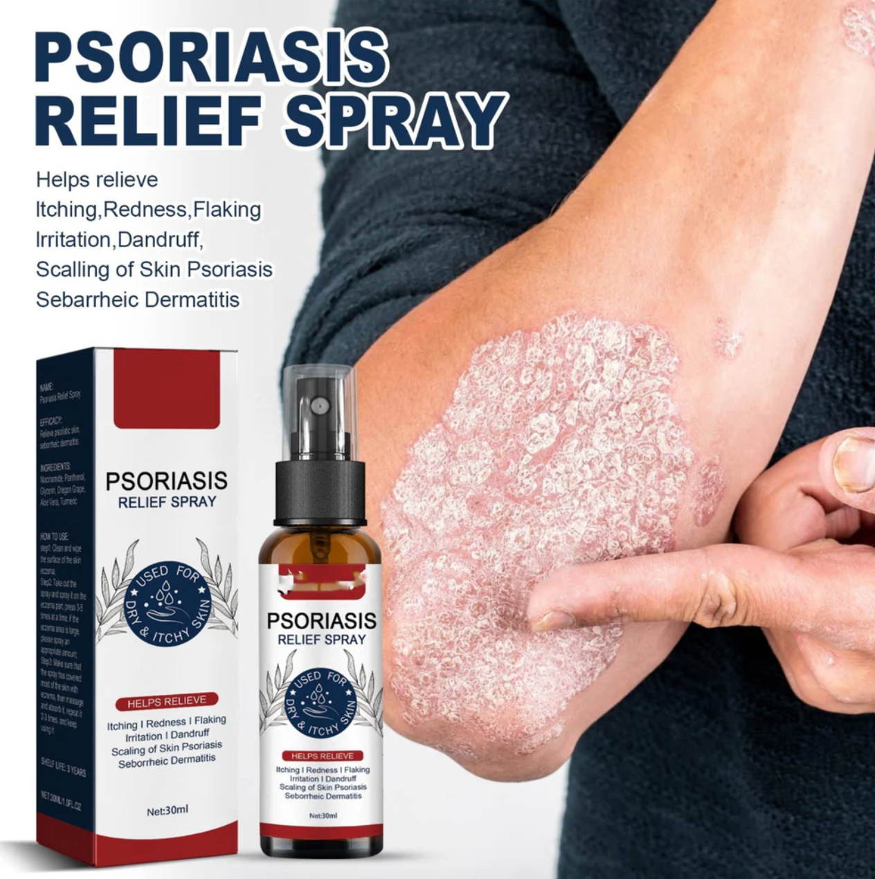 Psoriasis & Eczema & Others