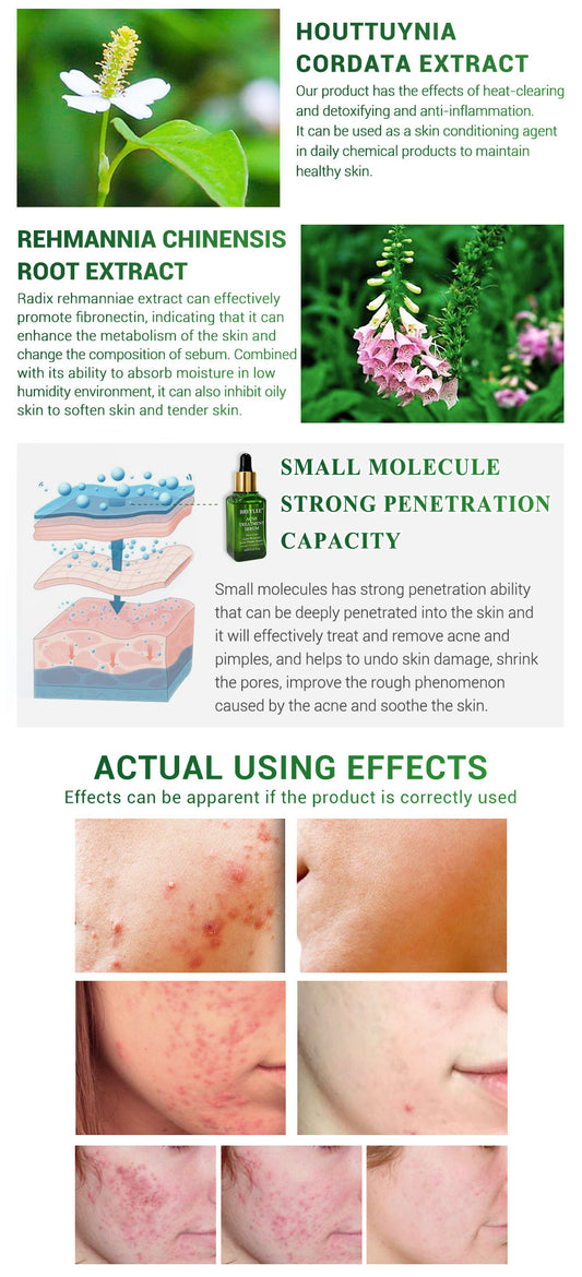 BREYLEE Acne Herbal Support Serum - Anti Acne Scar Removal Cream Skin Care Whitening Repair Acne Remover