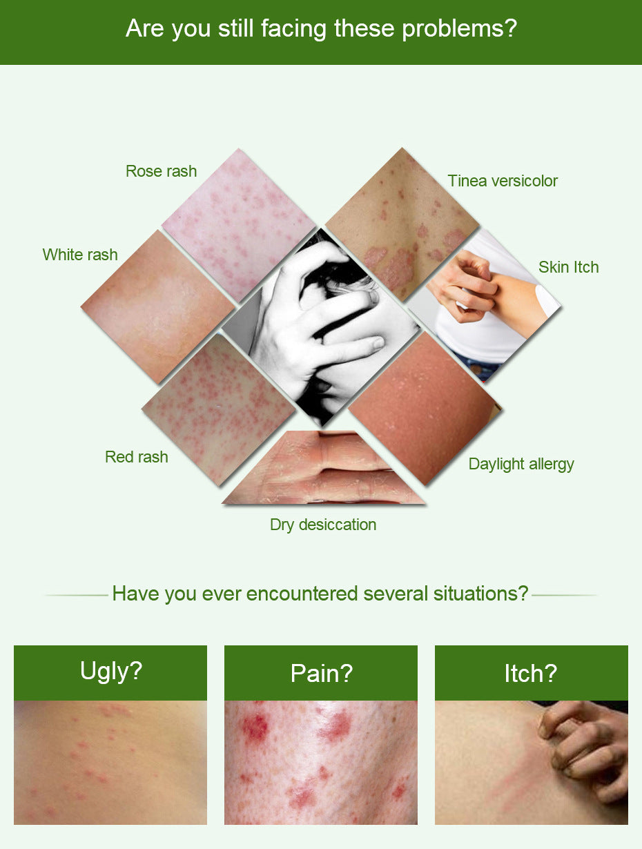 Lasso Herbal Rash Relief Cream – Fast-Acting, Antibacterial & Skin Barrier Support (Buy 3, Get 1 Free!)