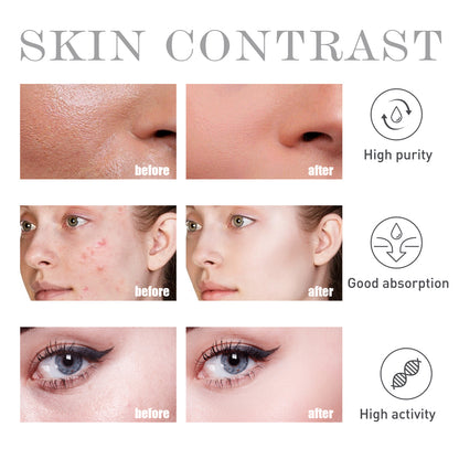 OUHOE Salicylate Acne & Blemish Control Water – Pore Purifying & Oil Balancing