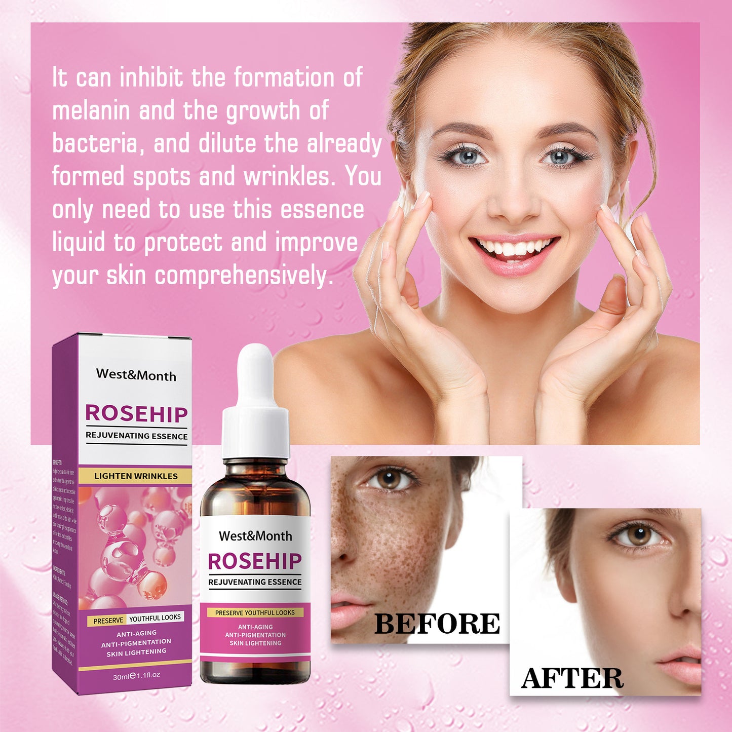 Rose Fruit Skin Rejuvenation Toner – Hydrating, Freckle & Dark Spot Remover