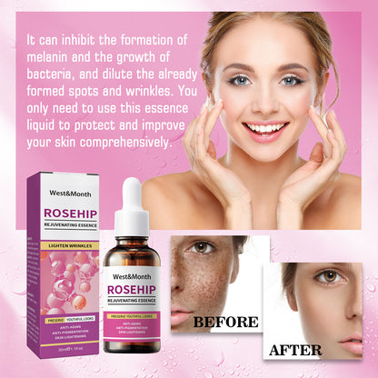 Rose Fruit Skin Rejuvenation Toner – Hydrating, Freckle & Dark Spot Remover