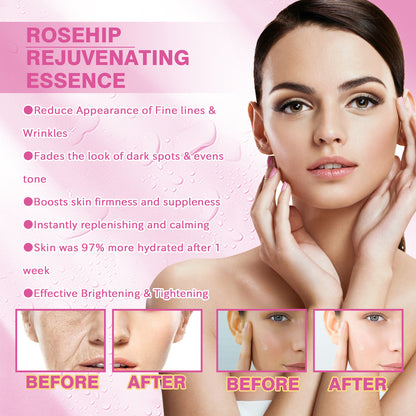 Rose Fruit Skin Rejuvenation Toner – Hydrating, Freckle & Dark Spot Remover